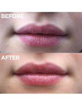 Load image into Gallery viewer, The Original 101 Ointment Multipurpose Superbalm: 15g / .52 Oz.