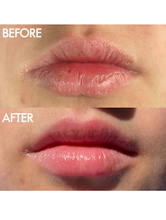 Load image into Gallery viewer, The Original 101 Ointment Multipurpose Superbalm: 15g / .52 Oz.